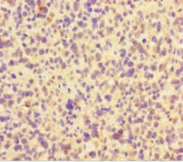 FAM117B / ALS2CR13 Antibody