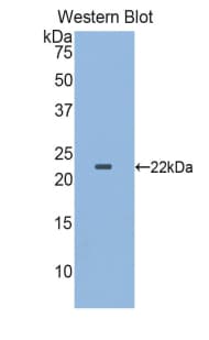 CSF3R / CD114 Antibody (aa655-837)