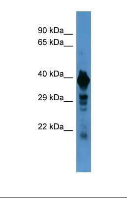 Polyclonal Rabbit anti-Human SLC18A1 / VMAT1 Antibody (aa54-103, WB)