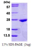 Human RAB22A / RAB22 Protein (Recombinant His)