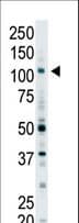Polyclonal Rabbit anti-Human EPS15L1 / EPS15R Antibody (aa186-216, WB)