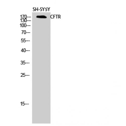 IHC-plus™ CFTR Antibody (680-760 aa)