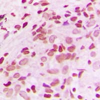 Polyclonal Rabbit anti-Human NR4A1 / NUR77 Antibody (Internal, IHC, WB)
