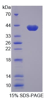 Rat Apolipoprotein C-I (Recombinant His-GST)