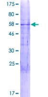 Human PPM1N Protein (Recombinant GST)