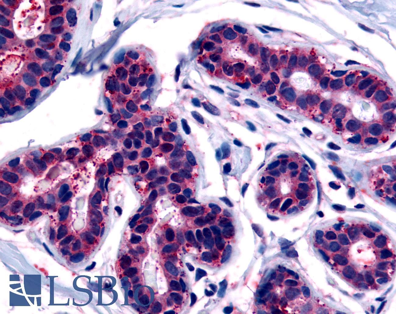 IHC-plus™ Polyclonal Rabbit anti-Human TRB3 / TRIB3 Antibody (C-Terminus, IHC)