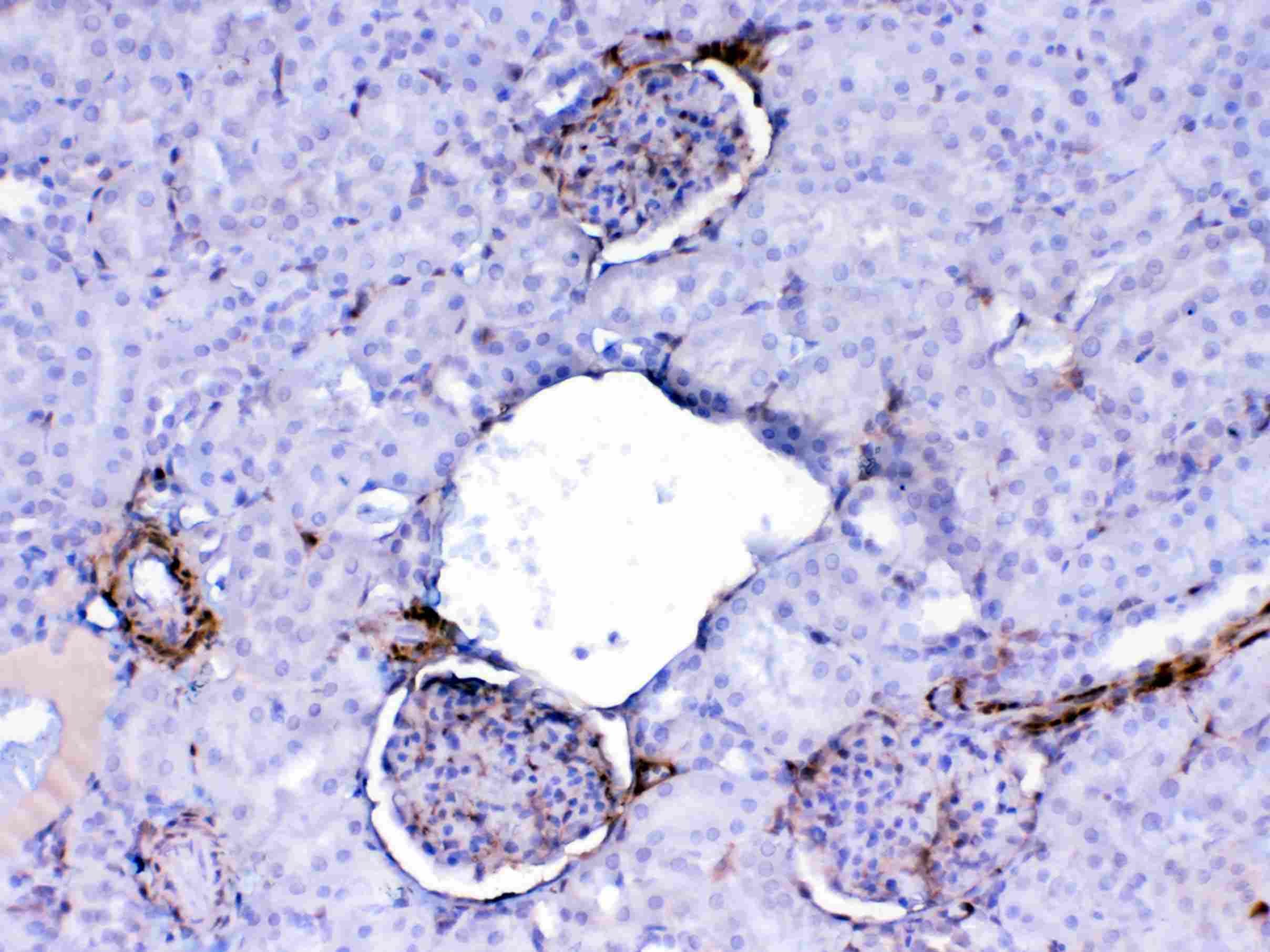 LGALS1 / Galectin 1 Antibody