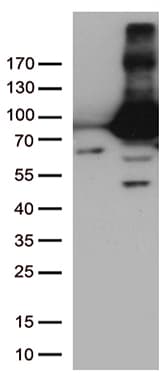 TGM2 / Transglutaminase 2 Antibody (clone OTI1C4)