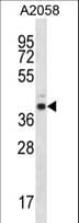 Polyclonal Rabbit anti-Human E2F3 Antibody (aa151-180, WB)