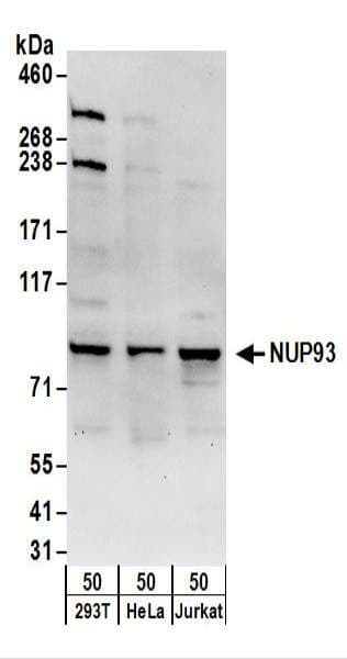 Polyclonal Rabbit anti-Human NUP93 Antibody (aa606-656, WB)