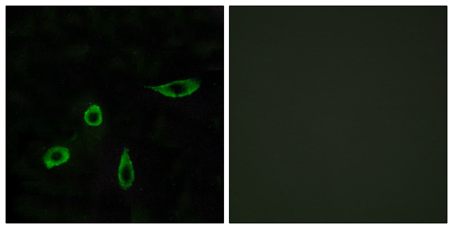 LPAR2 / EDG4 Antibody (aa290-339)