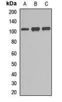 Polyclonal Rabbit anti-Human GEN1 Antibody (WB)