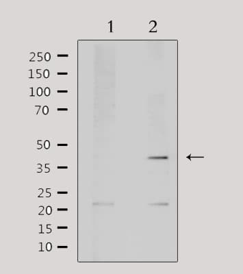 Polyclonal Rabbit anti-Human AIM2 Antibody (IF, WB)