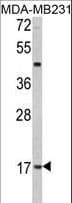 Leptin Antibody (aa134-166)
