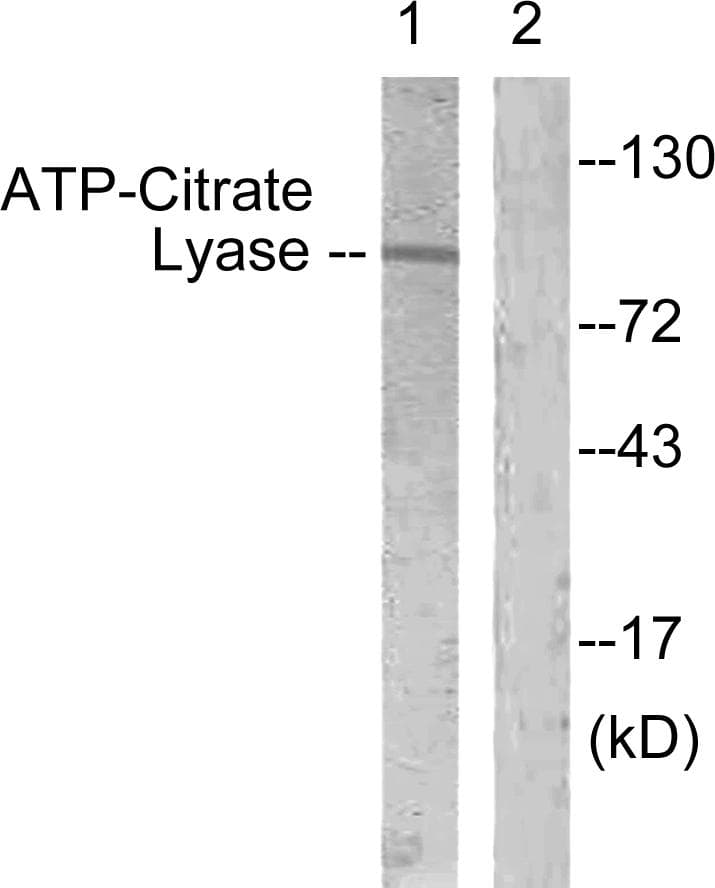 ACLY / ATP Citrate Lyase Antibody (p454)
