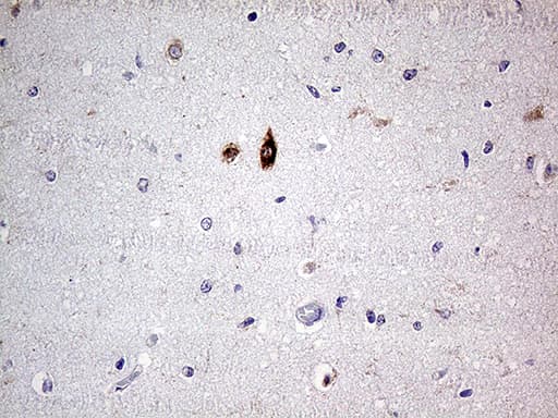 Monoclonal Mouse anti-Human SLC22A17 Antibody (clone OTI2D6, Carrier-free, aa241-300, IHC, WB)