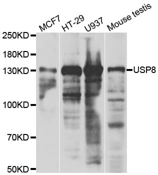 Polyclonal Rabbit anti-Human USP8 / UBPY Antibody (IHC, IF, WB)