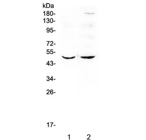 Polyclonal Rabbit anti-Mouse MEF2C Antibody (IHC, WB)