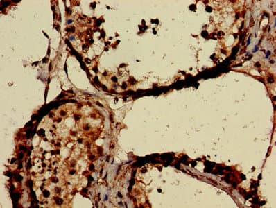 Polyclonal Rabbit anti-Human CLDN12 / Claudin 12 Antibody