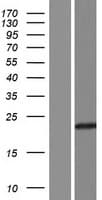 UBE2QL1 Protein (Over-Expression Lysate Myc-DDK (Flag))