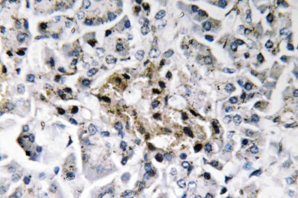 Insulin Antibody (Phe49)