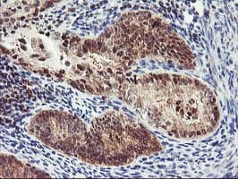 PDLIM2 / SLIM Antibody (clone OTI3B5)