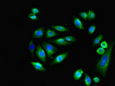 Polyclonal Rabbit anti-Human EMP1 Antibody (IHC)