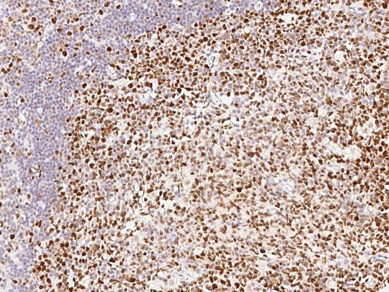 MSH6 Antibody (clone 021, Preservative Free)