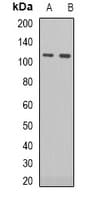 RB1 / Retinoblastoma / RB Antibody (C-Terminus)