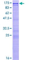 Human UTP14A Protein (Recombinant GST)