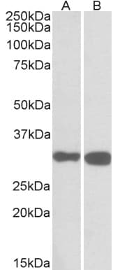 IHC-plus™ PDXP / Pyridoxal Phosphatase Antibody (aa275-286)