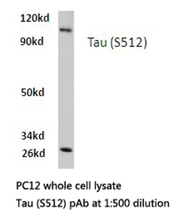 Polyclonal Rabbit anti-Human MAPT / Tau Antibody (Ser512, WB)