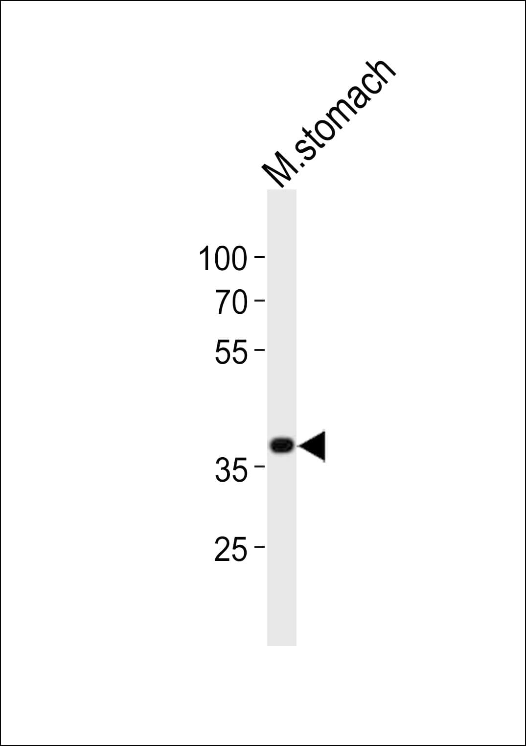 NKX2-5 Antibody (aa192-235)