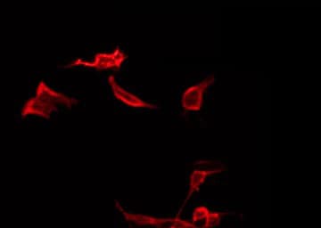 KRT19 / CK19 / Cytokeratin 19 Antibody
