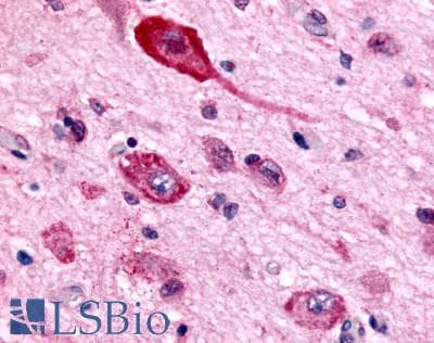 PathPlus™ Polyclonal Rabbit anti-Human GABBR1 / GABA B Receptor 1 Antibody (N-Terminus, IHC)