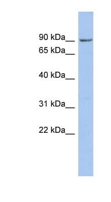 Polyclonal Rabbit anti-Human NPHP1 / Nephronophthisis Antibody (aa467-516, WB)