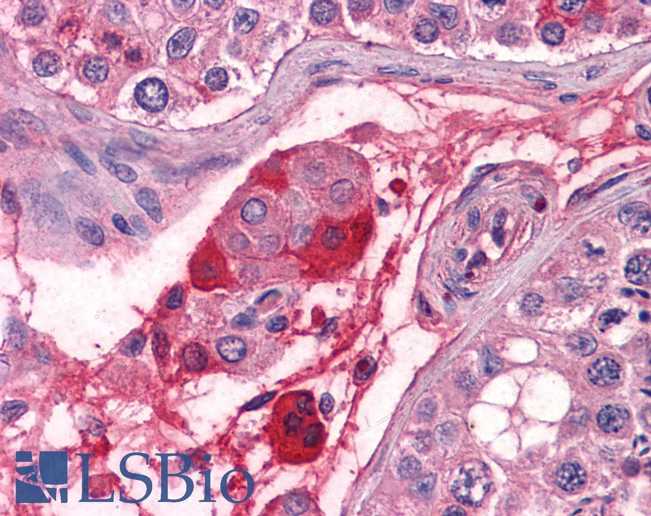 Polyclonal Sheep anti-Human F12 / Factor XII Antibody (IHC, WB)