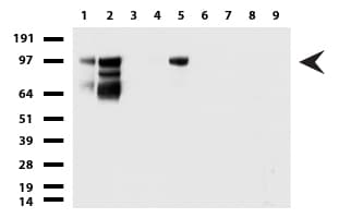 MCAM / CD146 Antibody (clone UMAB155)