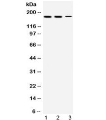 Polyclonal Rabbit anti-Human KDM5B / JARID1B Antibody (WB)