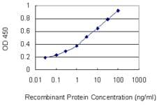 Monoclonal Mouse anti-Human DSC2 / Desmocollin 2 Antibody (clone 1F2, WB)