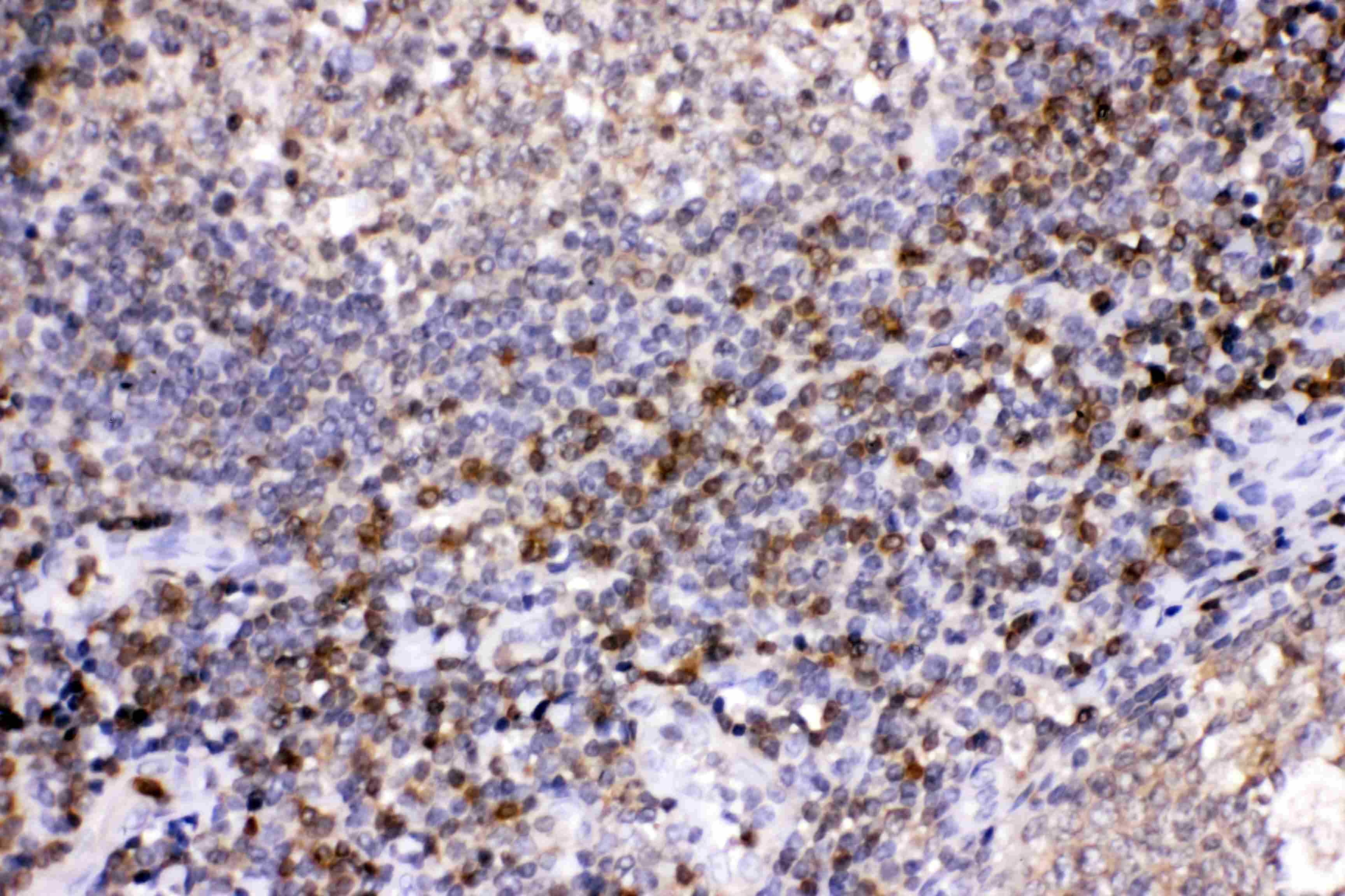 LDHB / Lactate Dehydrogenase B Antibody