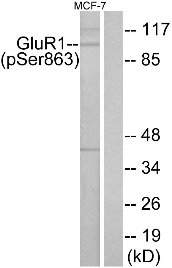 GRIA1 / GLUR1 Antibody (phospho-Ser863)