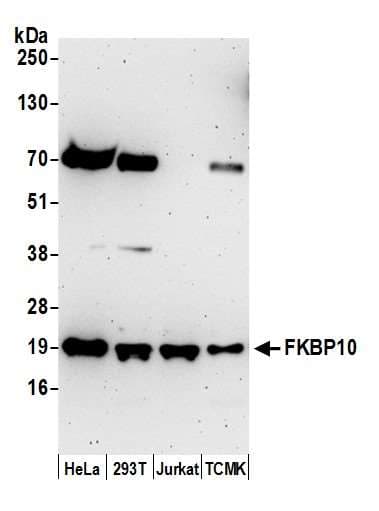 FKBP10 / FKBP65 Antibody (aa450-500)