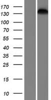 SMC1B Protein (Over-Expression Lysate Myc-DDK (Flag))