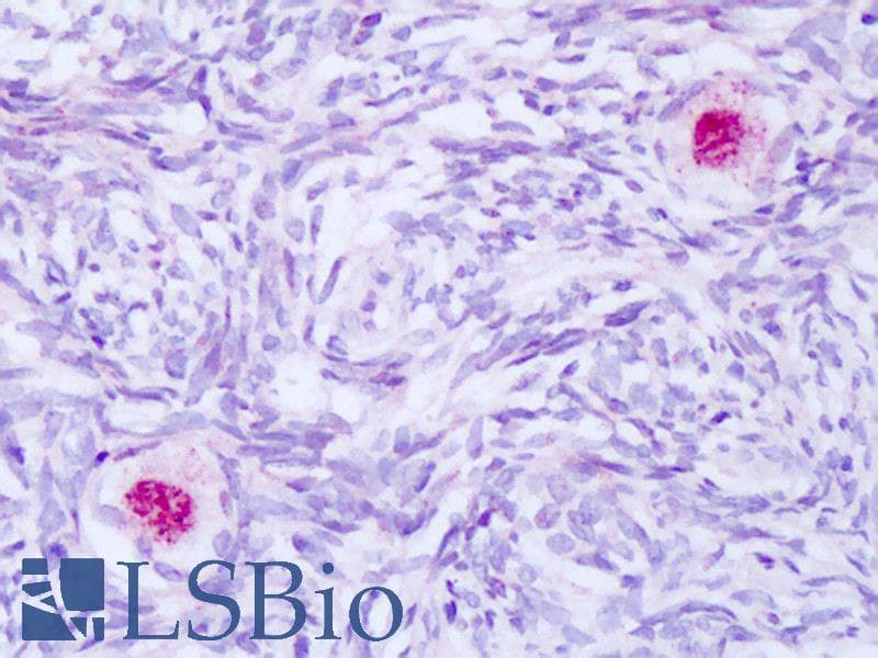 BAG1 / BAG-1 Antibody (aa112-161)