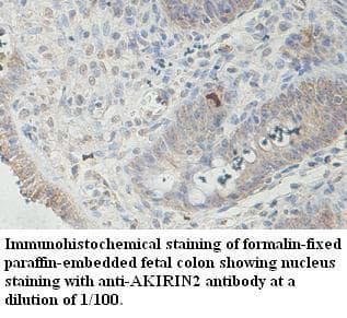AKIRIN2 Antibody (aa3-201)