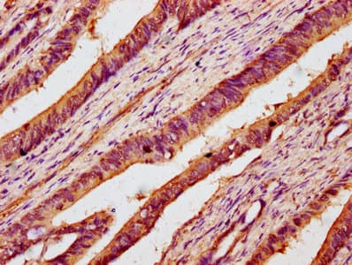 Polyclonal Rabbit anti-Human B3GNT6 Antibody (IHC, WB)