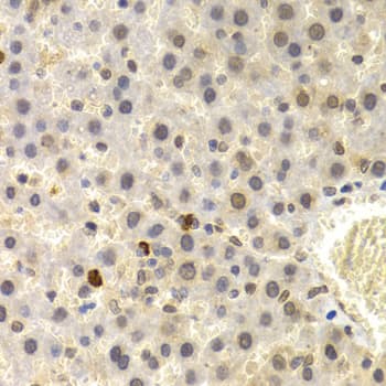 UMPS / OPRT Antibody