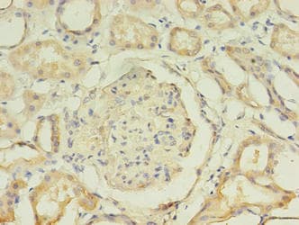 KATII / AADAT Antibody