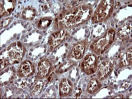SERPINB3 Antibody (clone OTI1A5)